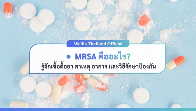 รู้จักเชื้อดื้อยา สาเหตุ อาการ และวิธีรักษาป้องกัน