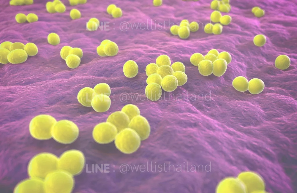 เชื้อ MRSA คือเชื้ออะไร